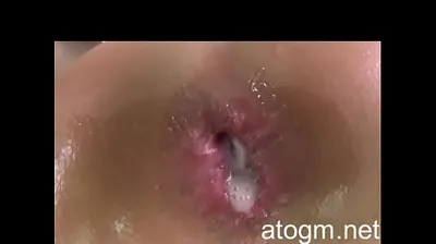 VLXX