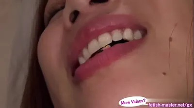 VLXX