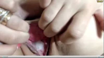 VLXX