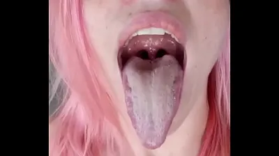 VLXX