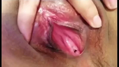 VLXX