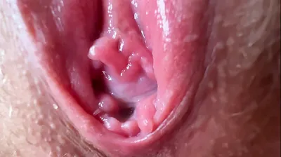 VLXX