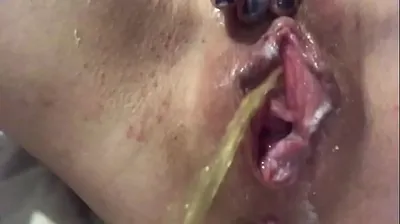 VLXX