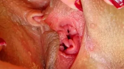 VLXX
