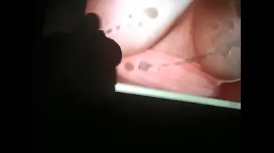 VLXX