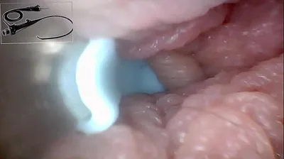 VLXX