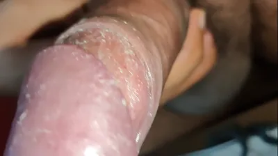 VLXX