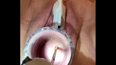 VLXX