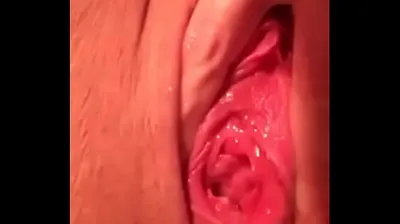 VLXX