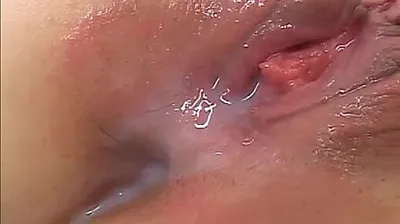 VLXX