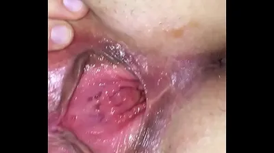 VLXX