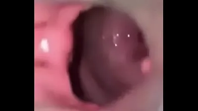 VLXX