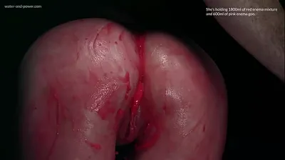 VLXX