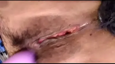 VLXX