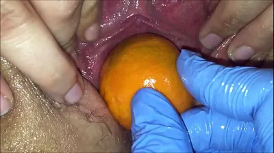 VLXX