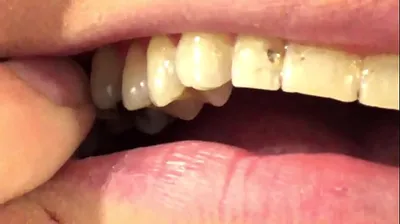 VLXX