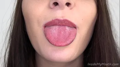VLXX