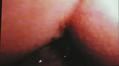 VLXX