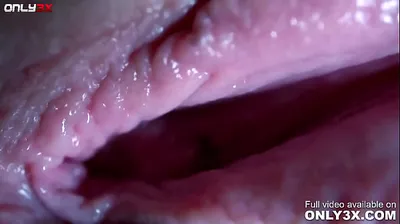 VLXX