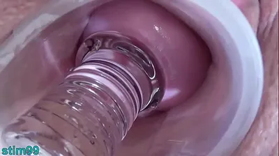 VLXX