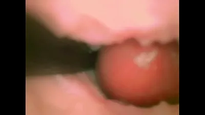 VLXX