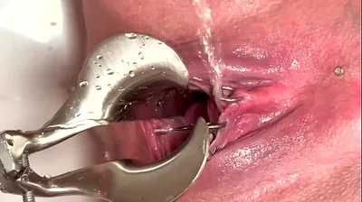 VLXX