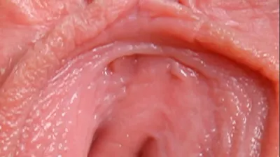 VLXX