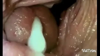 VLXX