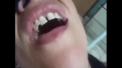 VLXX