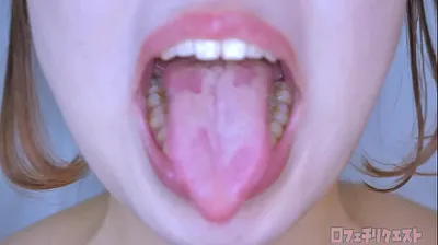 VLXX