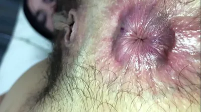 VLXX
