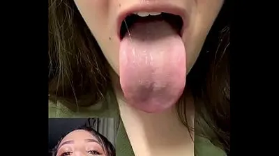 VLXX