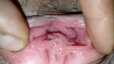 VLXX