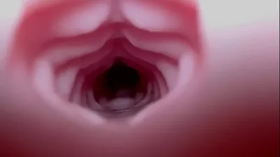 VLXX