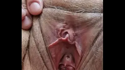 VLXX