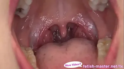 VLXX