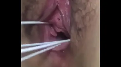 VLXX