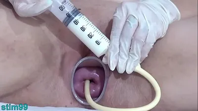 VLXX