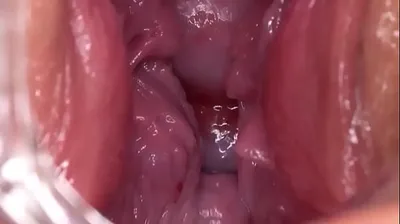 VLXX