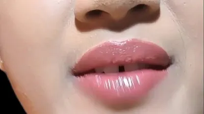 VLXX