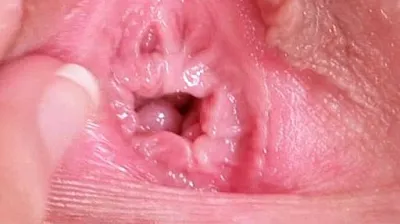 VLXX
