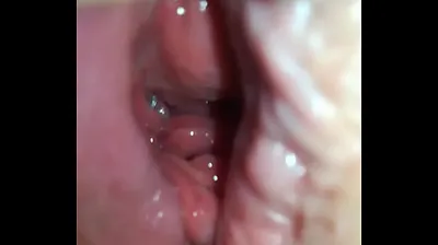 VLXX