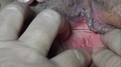 VLXX