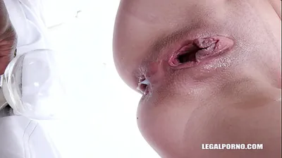 VLXX