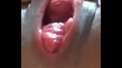 VLXX