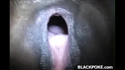 VLXX