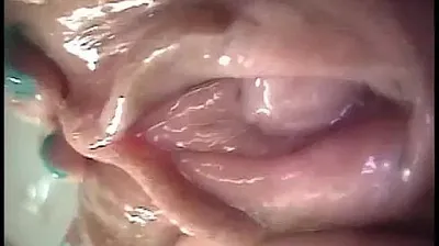 VLXX
