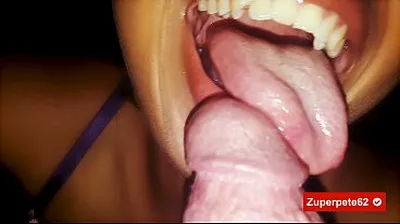 VLXX