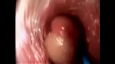 VLXX