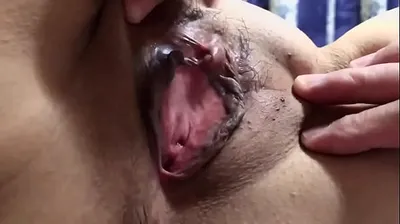 VLXX